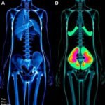 The Role of Body Imaging in Post-Operative Assessments