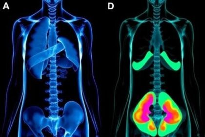 The Role of Body Imaging in Post-Operative Assessments