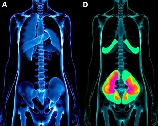 The Role of Body Imaging in Post-Operative Assessments