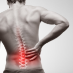 Choosing the Best Treatment Approaches for Persistent Back Pain