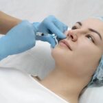 Fat Grafting for Facial Rejuvenation