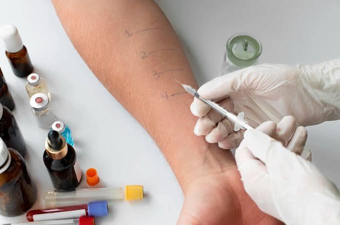 How Allergy Testing Can Help Identify Environmental Triggers