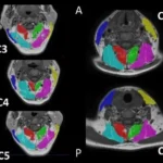 How To Prepare for Your Next MRI