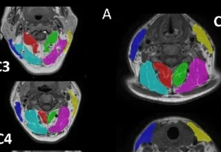 How To Prepare for Your Next MRI