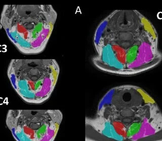 How To Prepare for Your Next MRI