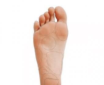 Preventing Plantar Warts