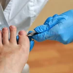 The Role of Proper Foot Care To Avoid Ingrown Toenails