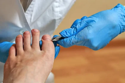 The Role of Proper Foot Care To Avoid Ingrown Toenails