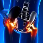 Understanding the Causes and Treatments for Hip Pain