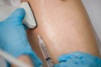 Signs That Help You Identify Varicose Veins