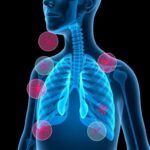 Understanding the Impact of Living With Asthma