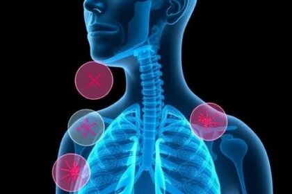 Understanding the Impact of Living With Asthma