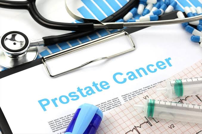Exploring Prostate Cancer Treatment From Clinical Trials and Research