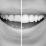 What To Evaluate When Visiting a Cosmetic Dentist