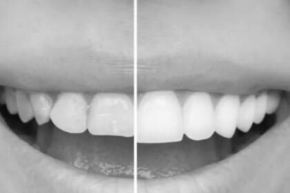 What To Evaluate When Visiting a Cosmetic Dentist